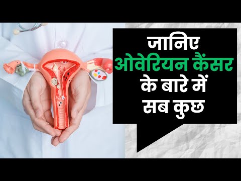 Understanding Ovarian Cancer: Everything You Need to Know I OnlyMyHealth [Video]