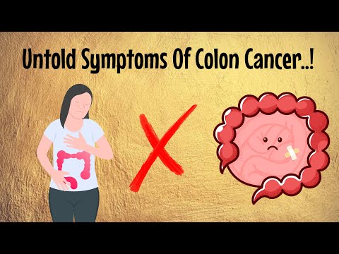 Colon Cancer – Symptoms, Prevention, Cure which requires urgent investigation [Video]