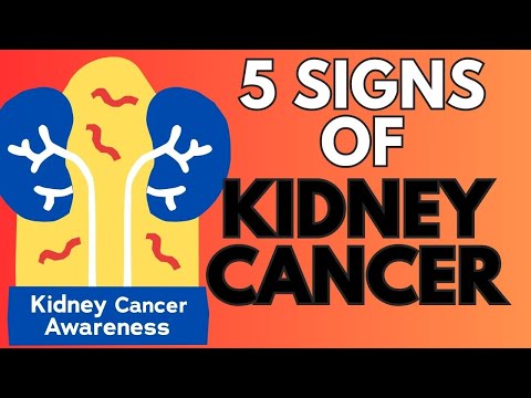 KIDNEY CANCER – WARNING Doctor explains –  The Unexpected Signs and Symptoms [Video]