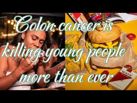 Colon cancer is killing young people more than ever What to know about the first signs of the diseas [Video]