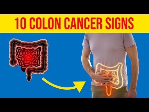 10 Warning Signs of Colon Cancer Not to Ignore | Colon Cancer Symptoms [Video]