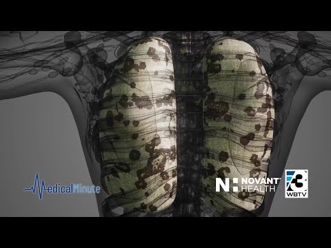Lung cancer screenings can help detect cancer early [Video]