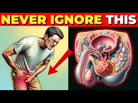 Critical Prostate Cancer Symptoms You Should NEVER Ignore [Video]