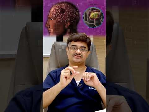 Metastatic Tumors of the Brain: Diagnosis and Treatment Dr.Roopesh Kumar Short 3 [Video]