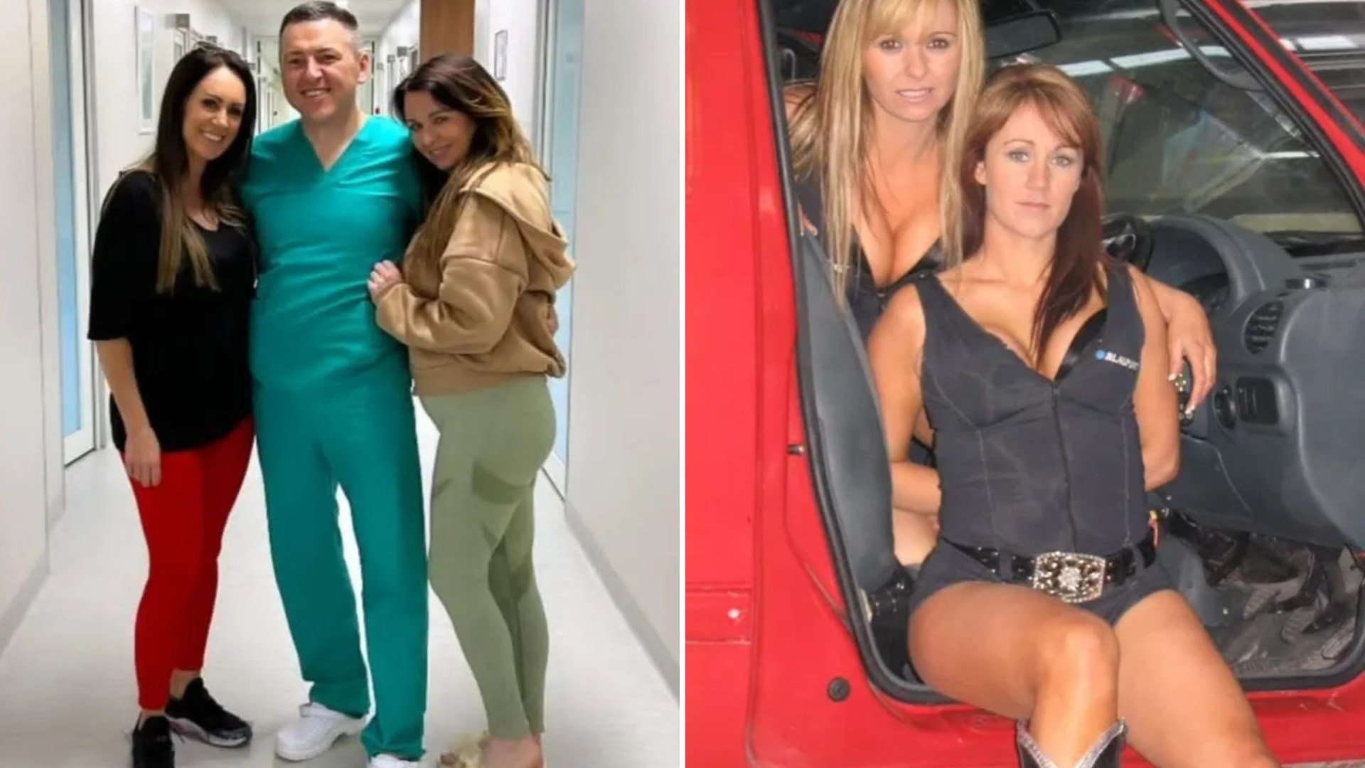 I ALWAYS copy my best friend’s surgery – I got a loan to match her 7.5k mummy makeover, I user her as my guinea pig [Video]