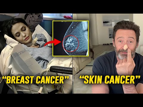 Shocking Revelations!!! Celebs You Didn’t Know Had Cancer – Recovered now [Video]