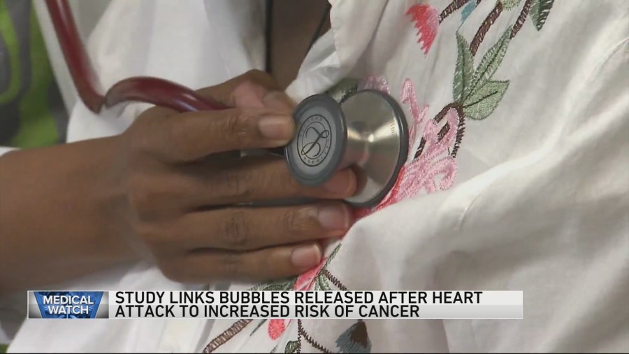 Study links bubbles released after heart attack to increased risk of cancer [Video]
