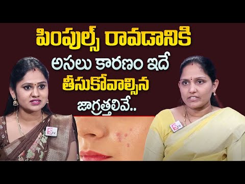 Pimple Causes and Treatment | A Maha Lakshmi Holistic Nutrition Coach | SumanTV Education [Video]