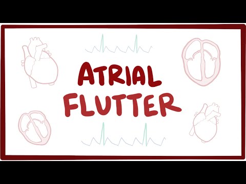 Atrial flutter – causes, symptoms, diagnosis, treatment, pathology [Video]