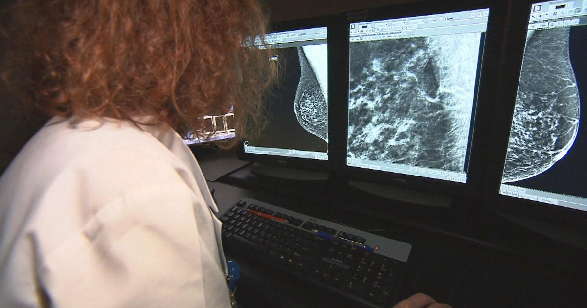 Data shows women are not getting recommended screenings for breast cancer [Video]