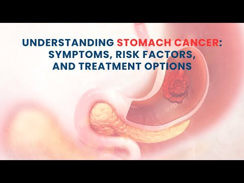 Understanding Stomach Cancer: Symptoms, Risk Factors, and Treatment Options [Video]