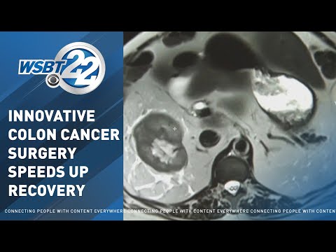 Eye on Health: Innovative colon cancer surgeries shorten recovery times [Video]