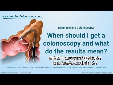 When should I get a colonoscopy and what do the results mean？ [Video]