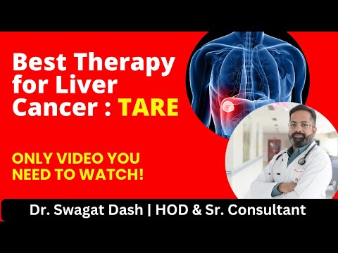 Best Therapy for Liver Cancer: TARE I TARE: Procedure, Side-effects, Recovery Time & Cost in India [Video]
