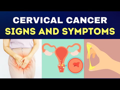 5 Vital Cervical Cancer Signs & Symptoms | Cancer Prevention [Video]