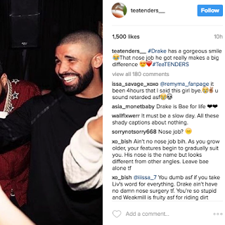 Drake – Nose Job? Did The Vocals Come In? [Video]