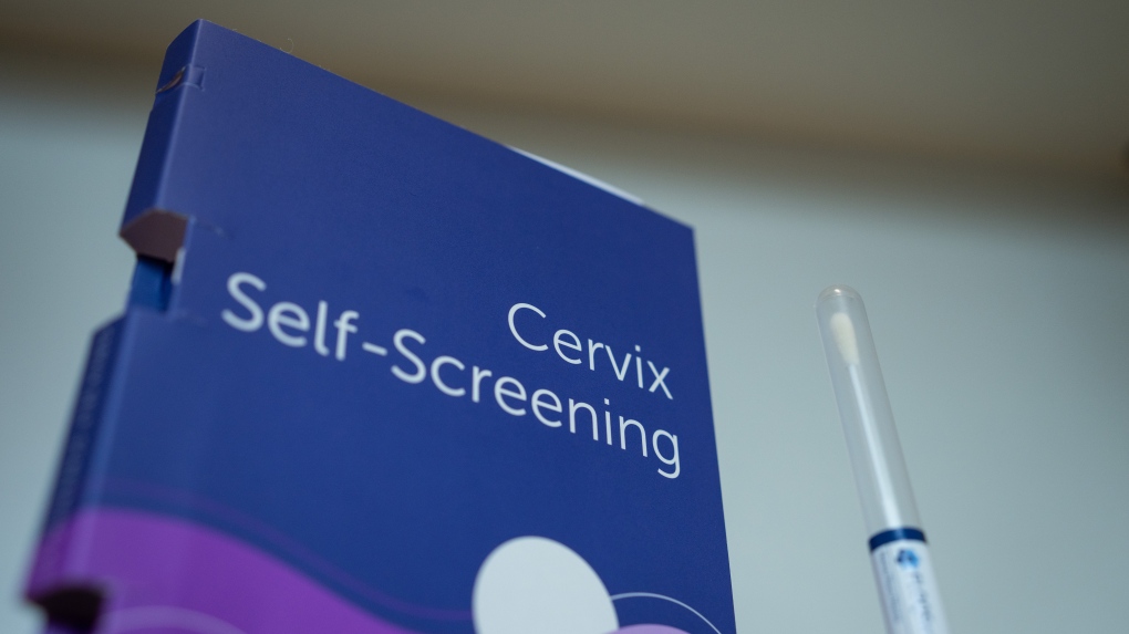 Cancer screening in Canada outdated: doctors [Video]
