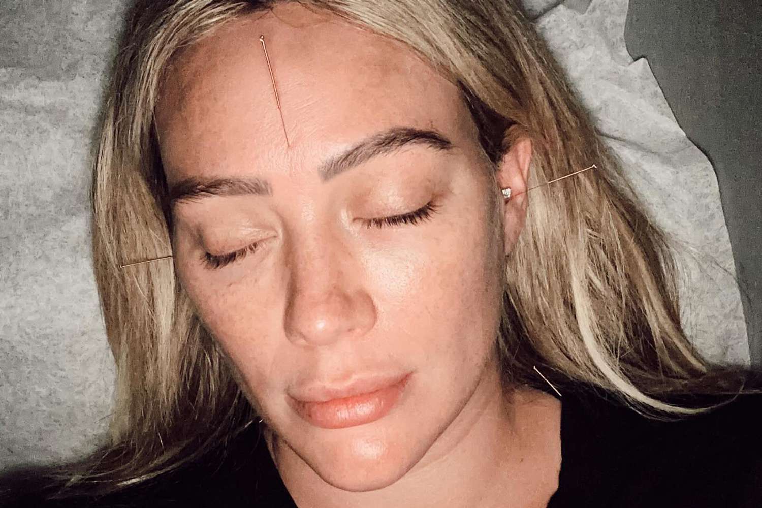 Pregnant Hilary Duff Gets Acupuncture, Jokes It’s Baby’s ‘Eviction Notice’ [Video]