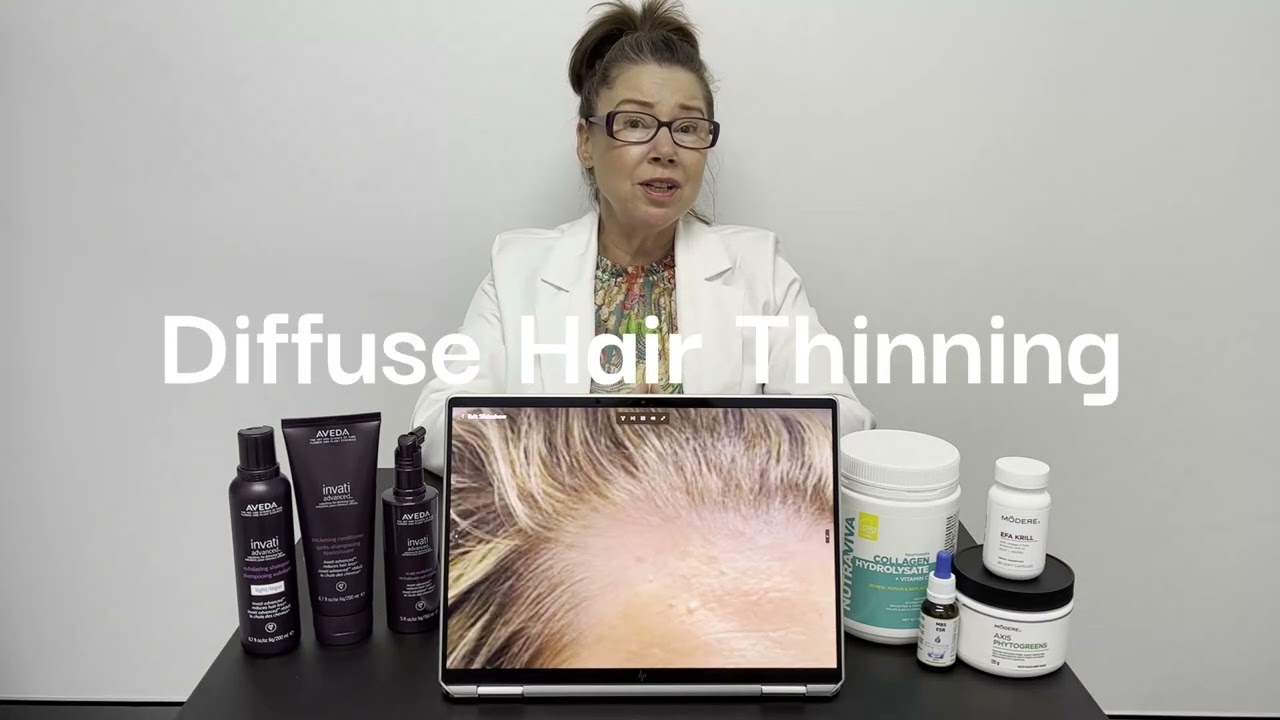 New Hair Growth Treatment for Women [Video]