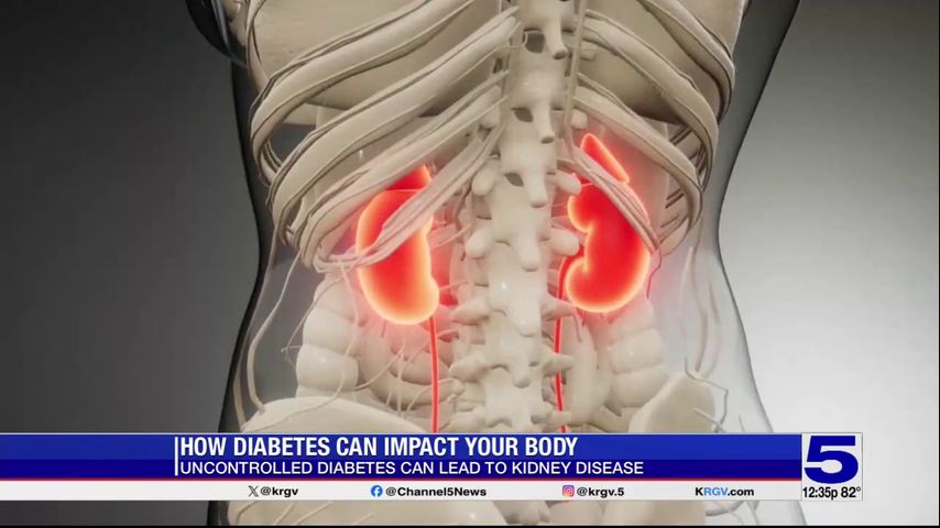 Heart of the Valley: How diabetes can affect the body [Video]