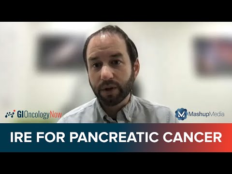 Local Ablation in Pancreatic Cancer: Ongoing Trials and Investigative Directions [Video]