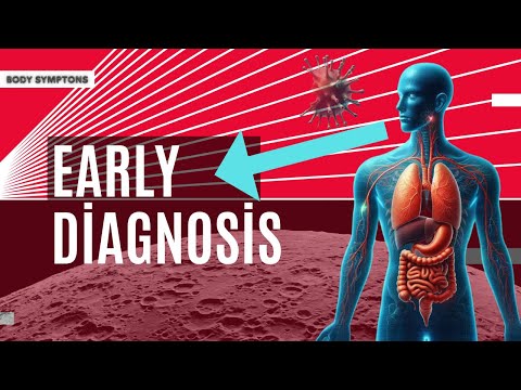 early diagnosis is important | Symptoms of sarcoidosis | [Video]