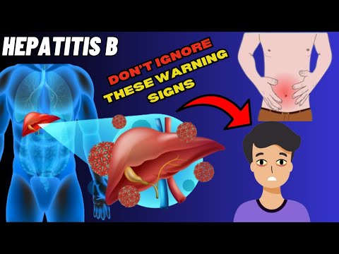 Identify Warning Signs of Hepatitis B | Signs and Symptoms of Hepatitis B [Video]