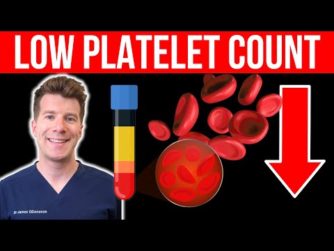 Doctor explains LOW PLATELET COUNT (Thrombocytopenia) | Causes, symptoms and more [Video]