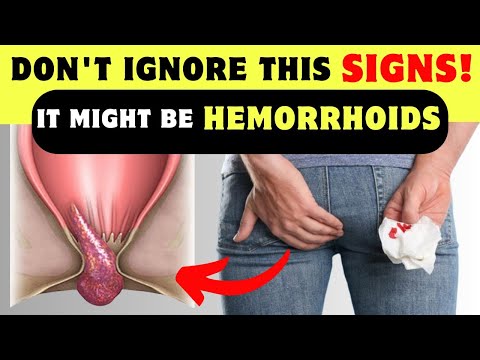DID YOU KNOW? Hemorrhoids: 5 Symptoms, Risk Factors and Treatment [Video]