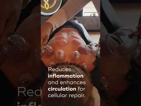 Embrace the marks of healing with Cupping Therapy [Video]