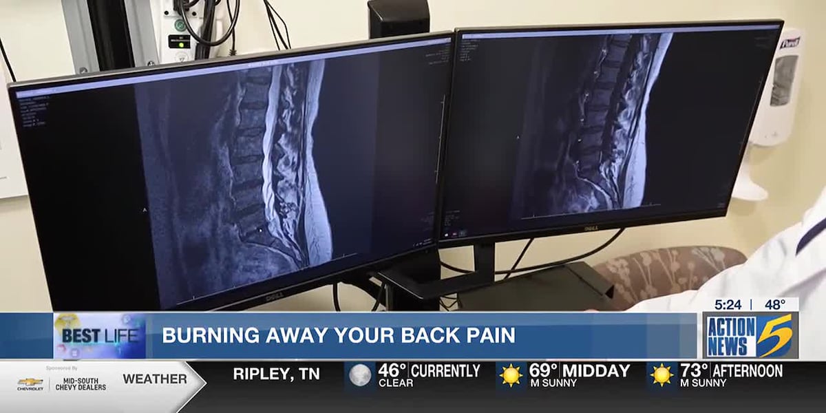 Best Life: Burning away your back pain [Video]