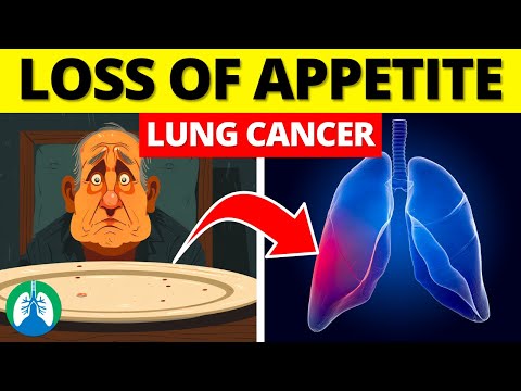 Loss of Appetite and Lung Cancer? 🫁 [Video]