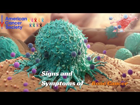 American Cancer Society | Spotlighting Silent Signals: 20 Overlooked Cancer Symptoms in Men & Women [Video]