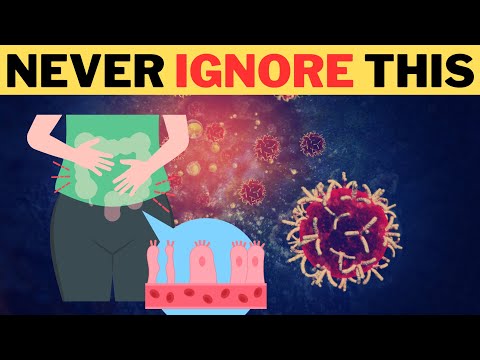 Understanding colon cancer risks and symptoms || The hidden truth about colon cancer [Video]