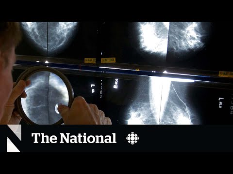 Canada’s cancer screening guidelines are out of date, doctors say [Video]