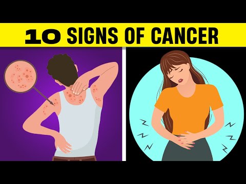 10 Cancer Signs that 90% of People Ignore [Video]