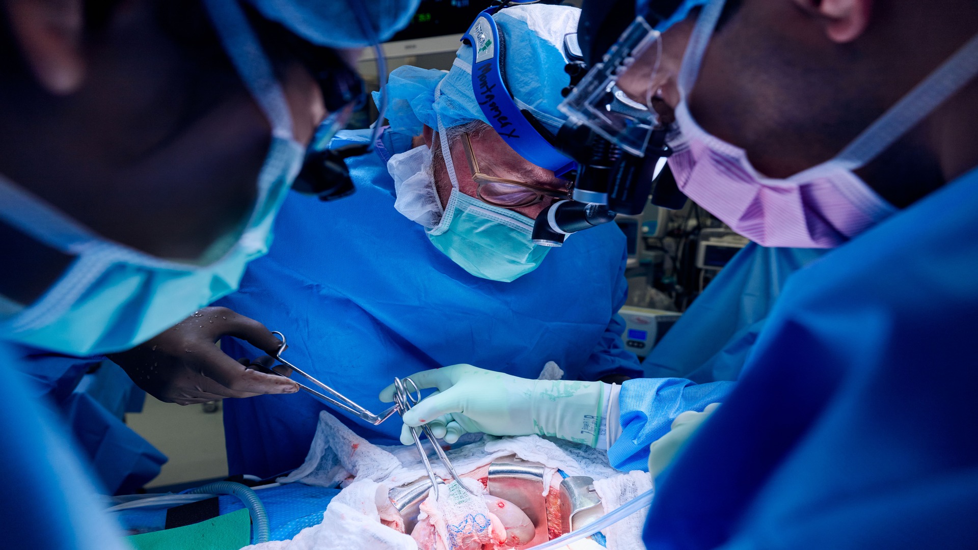 First combined heart pump and pig kidney transplant successful [Video]