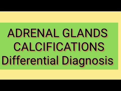 ADRENAL GLAND Calcifications Differential Diagnosis [Video]