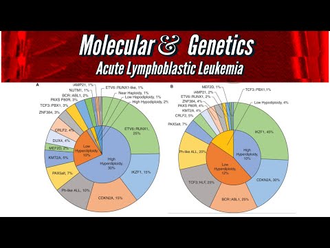 Molecular & Genetics of Acute Lymphoblastic Leukemia #pathology lectures [Video]