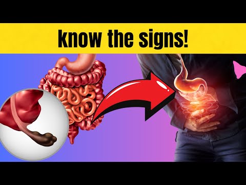 What are the warning signs of colon cancer you shouldn’t ignore? | HEALTHY FRIENDS | BESTIE [Video]