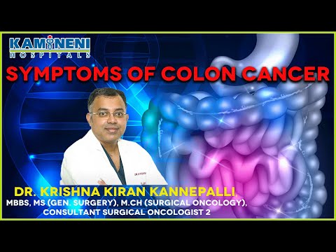 What is Colon Cancer | Sign & Symptoms | Dr.Krishna Kiran Kannepalli | Kamineni Hospital [Video]
