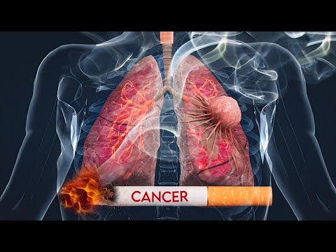 How Cancer Starts ?  : 3D Animation [Video]
