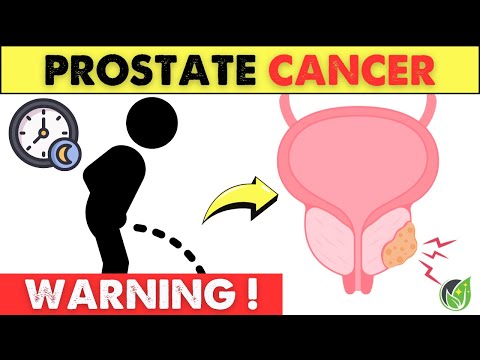 Don’t Ignore 4 WARNING Signs of Prostate Cancer That You Might Not Know! | Health Journey [Video]