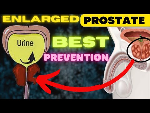 Prostate Health: Best Foods for Prevention. [Video]