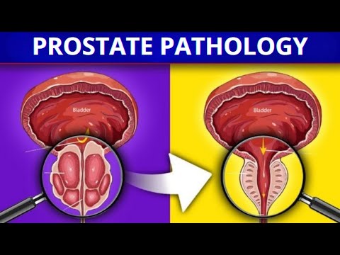 THE ULTIMATE GUIDE TO PROSTATE HEALTH: EVERYTHING YOU NEED TO KNOW [Video]