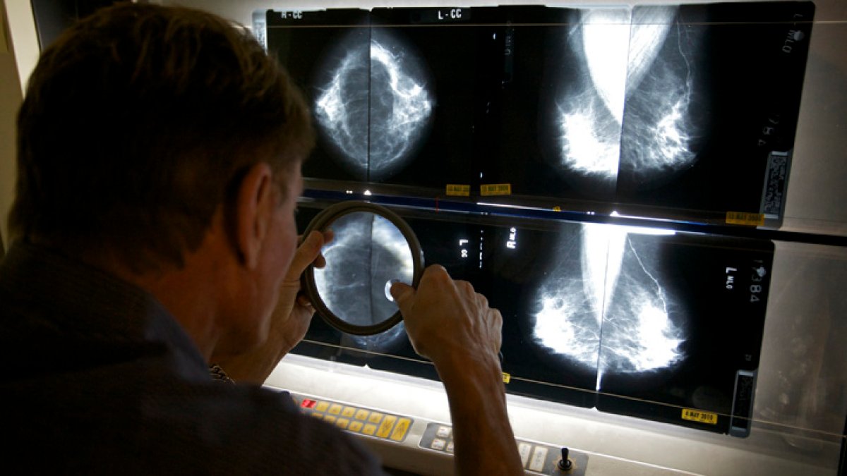 What is the recommended age for a mammogram? Panel issues new guidelines  NBC Boston [Video]