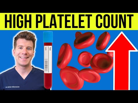 Doctor explains HIGH PLATELET COUNT (Thrombocytosis) | Causes, symptoms and more [Video]