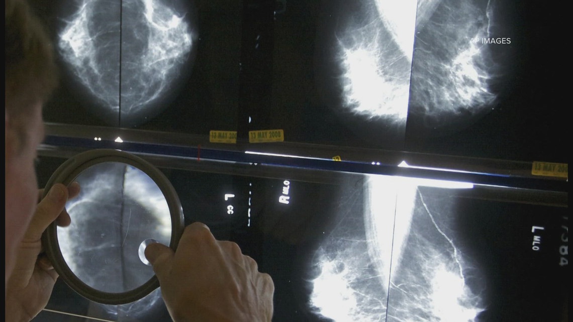 Here’s when experts say you should get a mammogram [Video]