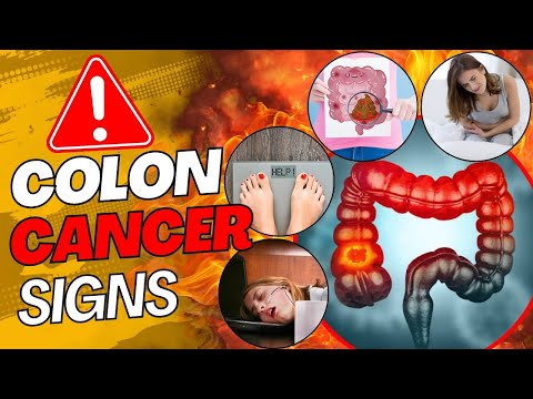 Most Alarming Colon Cancer Symptoms You Need To Spot ASAP! | Fit&Fab [Video]
