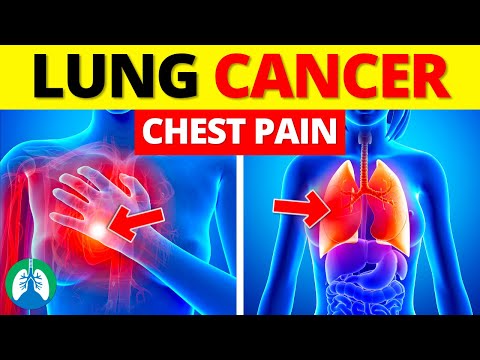 Chest Pain and Lung Cancer | EXPLAINED ⚠️ [Video]